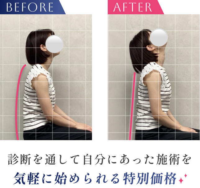ビフォーアフター